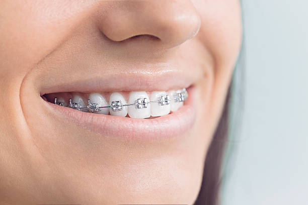 Best Veneers and Lumineers  in Von Ormy, TX